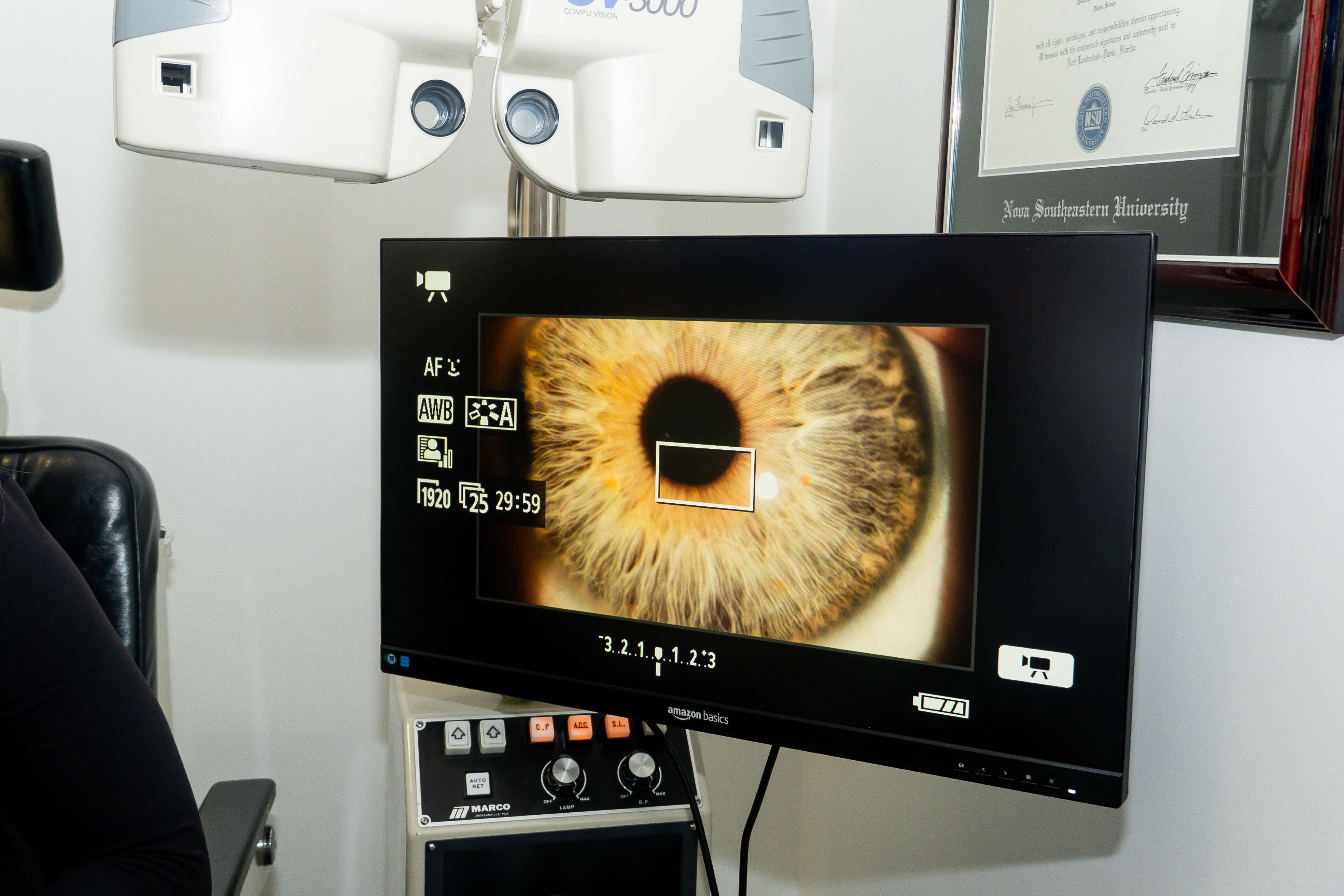 High-precision iris scan on diagnostic monitor